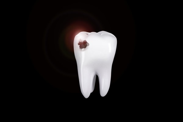 What To Ask Your Pediatric Dentist About Cavity Treatment For Kids