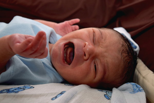 Frenectomy: Ask A Pediatric Dentist About Newborn Lip And Tongue Tie